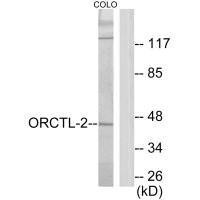 SLC22A18 Antibody (PACO21926)