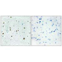 DCLK3 Antibody (PACO21947)
