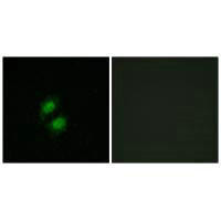 ZKSCAN5 Antibody (PACO21990)
