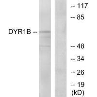 DYRK1B Antibody (PACO21994)