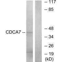 CDCA7 Antibody (PACO22028)