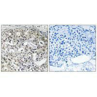 CNTD2 Antibody (PACO22035)
