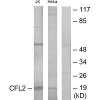 CFL1/CFL2 Antibody (PACO22037)