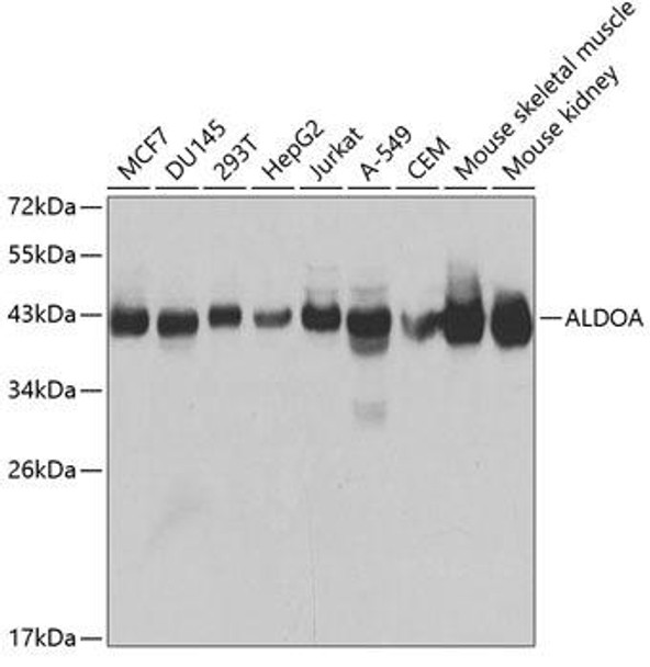 Anti-ALDOA Antibody (CAB1142)
