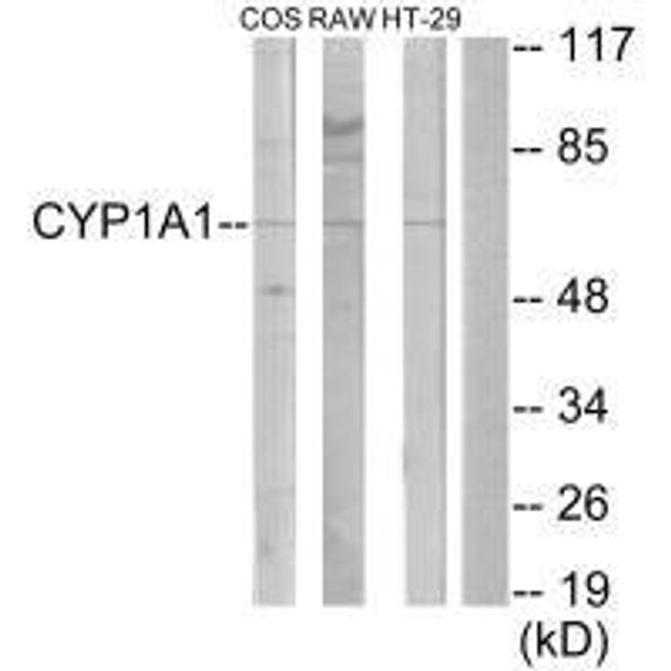 CYP1A1/CYP1A2 Antibody (PACO22041)