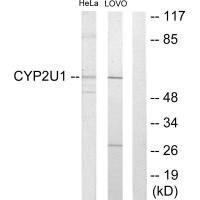 CYP2U1 Antibody (PACO22049)