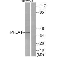 PHLDA1 Antibody (PACO22074)