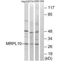 MRPL10 Antibody (PACO22084)