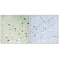 ABHD14B Antibody (PACO22112)