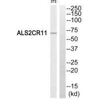 ALS2CR11 Antibody (PACO22143)