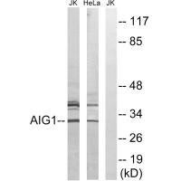 AIG1 Antibody (PACO22146)