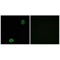 ABCA13 Antibody (PACO22167)