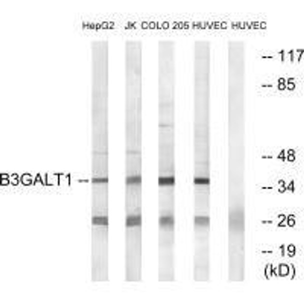 B3GALT1 Antibody (PACO22194)