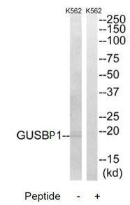GUSBP1 Antibody (PACO22203)