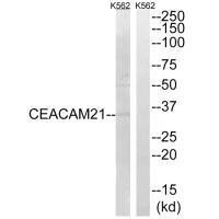 CEACAM21 Antibody (PACO22242)
