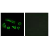 NT5C1B Antibody (PACO22296)