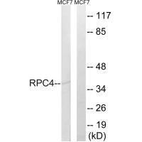POLR3D Antibody (PACO22314)