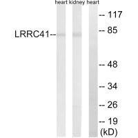 LRRC41 Antibody (PACO22386)