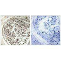 MRPS5 Antibody (PACO22421)