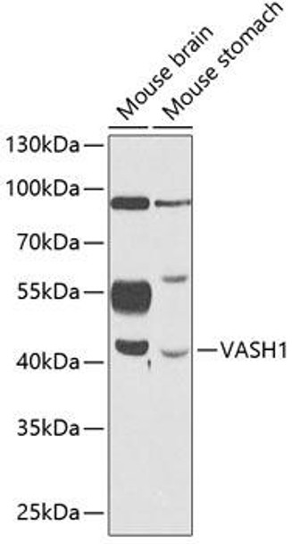 Anti-VASH1 Antibody (CAB12569)