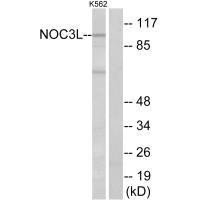 NOC3L Antibody (PACO22481)