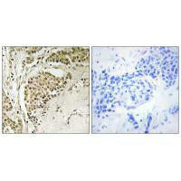 NOM1 Antibody (PACO22482)