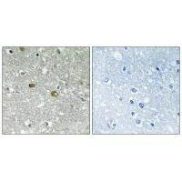 PIGH Antibody (PACO22499)