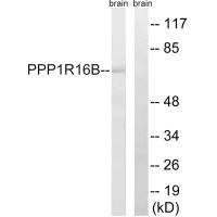 PPP1R16B Antibody (PACO22524)