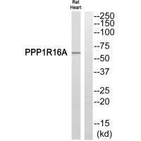 PPP1R16A Antibody (PACO22525)