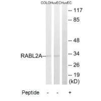 RABL2A Antibody (PACO22539)