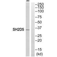 SH2D5 Antibody (PACO22609)
