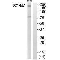 SCN4A Antibody (PACO22616)