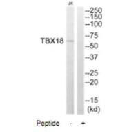 TBX18 Antibody (PACO22644)