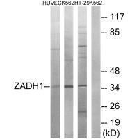 PTGR2 Antibody (PACO22701)