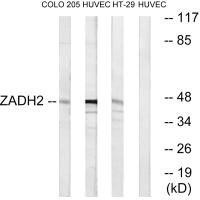 ZADH2 Antibody (PACO22702)