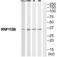RNF113B Antibody (PACO22721)
