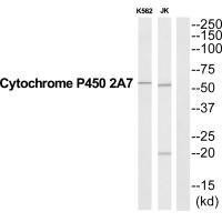 CYP2A7 Antibody (PACO22785)