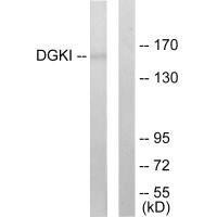 DGKI Antibody (PACO23177)