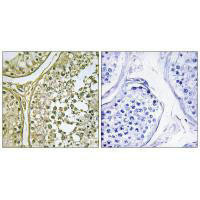 CSNK1A1L/CSNK1A1 Antibody (PACO23264)