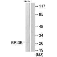BRI3BP Antibody (PACO23273)
