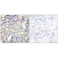 COL5A2 Antibody (PACO23313)