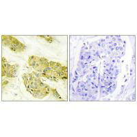 COL5A3 Antibody (PACO23314)