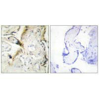 LAMA2 Antibody (PACO23341)
