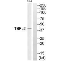TBPL2 Antibody (PACO23503)
