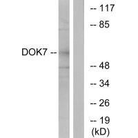 DOK7 Antibody (PACO23751)