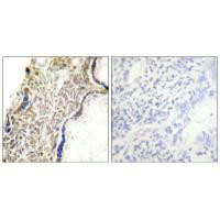 CDKN2A Antibody (PACO23834)