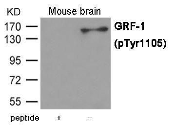 Phospho-ARHGAP35 (Tyr1105) Antibody (PACO23932)