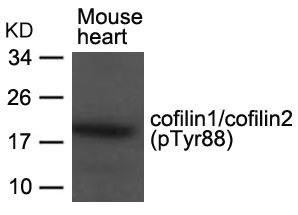 Phospho-CFL1/CFL2 (Tyr88) Antibody (PACO24337)