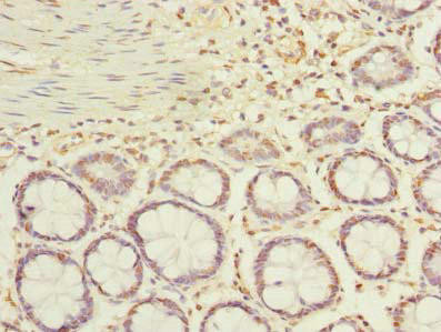 ACTRT1 Antibody (PACO24739)