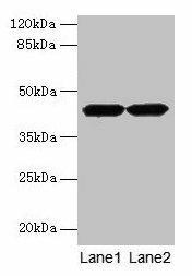 ACTRT2 Antibody (PACO24743)